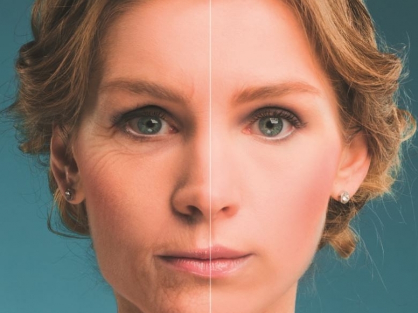 BOTOX E PREENCHIMENTO LABIAL...